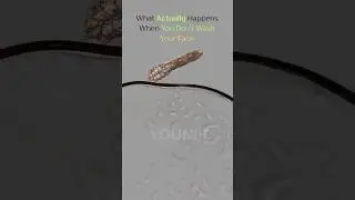 This is how Demodex Mites Living on Your Face. #ytshorts #face #skincare #health #routine #younik