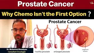 Best Treatment for Prostate Cancer in 2025 &mdash; What Doctors Recommend