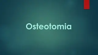 Osteotomia na exodontia | Odontologia | Dra Bianca Rosa