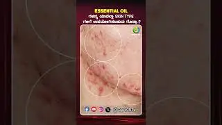 Essential Oil ಗಳನ್ನ ಯಾವೆಲ್ಲಾ Skin Type ಗಳಿಗೆ ಉಪಯೋಗಿಸಬಹುದು ಗೊತ್ತಾ..? | BeautyTips | Ayush TV