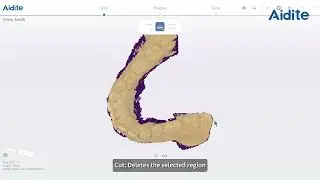 3 Aidite Rapid 3 Intraoral Scanner: Restoration Scan