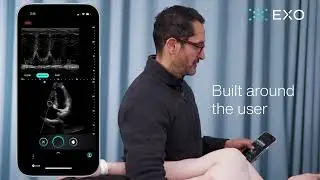 AI-Enabled Cardiac Ultrasound for Clinicians | Exo Iris&trade;