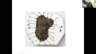 CDE 101: Gastrointestinal Malignancies