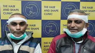 Hair Transplant Patients review from Madhya Pradesh MP Plastic Surgery Clinic Malad Mumbai Dr.Umang