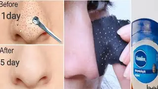 Clean Nose, Natural Glow
