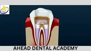 #ROOT CANAL BENEFITS#dental #dentaleducation #