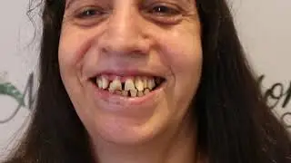 Smiling looks good on you! / Mono Dentistry💎