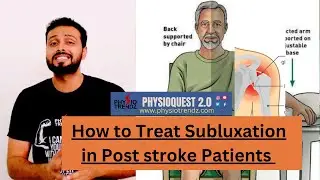 Shoulder Subluxation Post-Stroke: Doctors' Approved Treatment