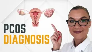 PCOS Diagnosis (Polycystic Ovarian Syndrome) - 3 Rotterdam Criteria