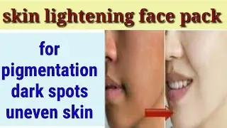 face pack for skin lightning | lemon peel powder face pack