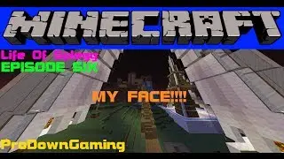The Life Of Splegg EPISODE SIX (MY FACE :PPPP)