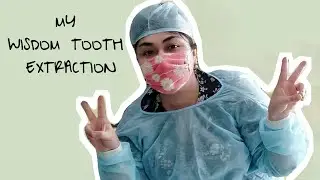 My First Wisdom Tooth Extraction Experience | Bharti Puri
