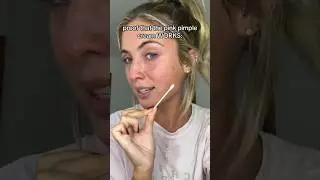 VIRAL NEW ACNE PRODUCT!😱 (follow for more!💗) #acne #beautytips #skincare #skin #skincareroutine