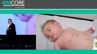 Syncope in children