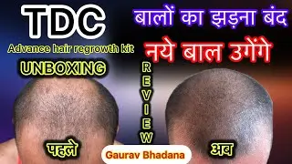 Tdc advance hair growth kit review || unboxing || how to use tdc advance hair regrowth kit ||