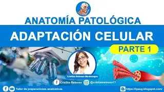Adaptaci&oacute;n Celular-Parte 1 (HIPERTROFIA-HIPERPLASIA)