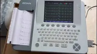 jM ecg machine 6 channel
