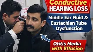 Hearing Test & Diagnosis | Conductive Hearing Loss Due to Otitis Media