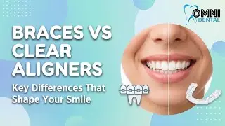 Braces vs Clear Aligners | Which Is Right for Your Smile?