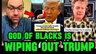 TRUMP Accidentally REVEALS his discoloured hands & He Knows what's coming after.Americans re HOPEFUL