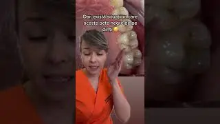 CE SUNT PETELE NEGRE DE PE DINTI?