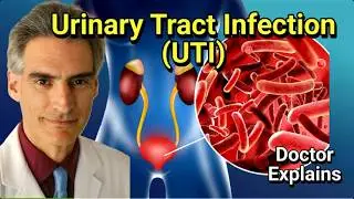 UTI Symptoms, Causes, and Treatment | Doctor Explains Urinary Tract Infections