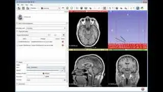 Display tracked tool or imaging device status in 3D Slicer