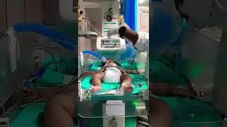 patient is serious #neonatalcare #cutebaby #medical #youtube #video #viral