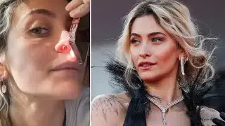 Michael Jackson's daughter, Paris, reveals the aftereffects that drugs left on her nose