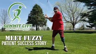 Amputee Success Story: Fuzzy