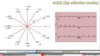 AQRS (Mean Electrical Axis)