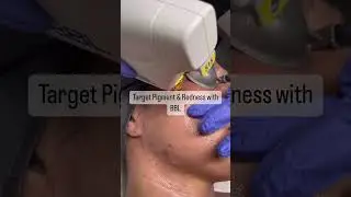 ELLEMES Medical Spa | Atlanta, GA