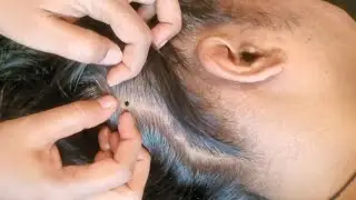 Scalp Check ASMR | Hair Loss, Tingles & Triggers