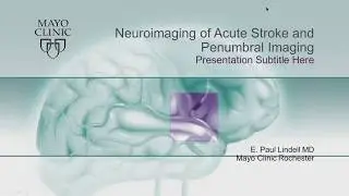 Neuroimaging of Acute Stroke & Penumbral Imaging by E. Paul Lindell, MD | Preview