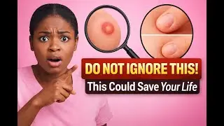 5 Breast Cancer Signs Many Women Ignore.  #breastcancer #breastcancerawareness