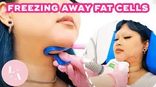 Jada | CoolSculpting Testimonial