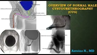 Normal male cystourethrography