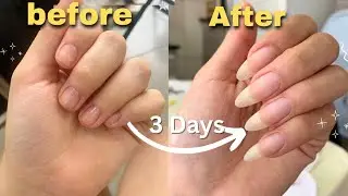 Как отрастить длинные, белые и крепкие ногти ✨️🎀 || Результат за 3 дня 🍒