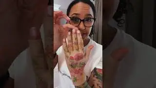 What compression do you need to manage lymphedema in your arm and hand