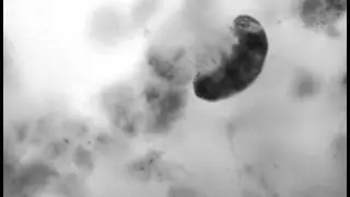 Tardigrade (