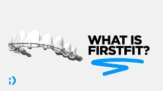 What is FirstFit?