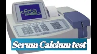 Serum calcium test.... How is a calcium test..