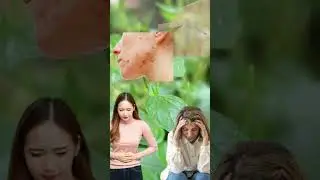 Wild herb benefit - Peperomia Pellucida health benefit
