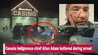 Canada indigenous chief Allan Adam battered during arrest  | UK News Times | UKNT