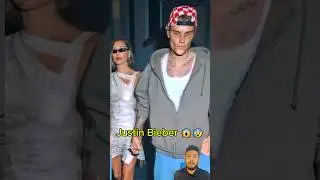 Justin Bieber 2025 😱😢 #justinbieber