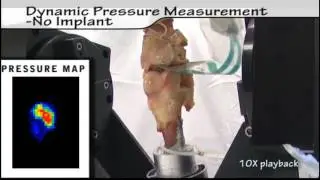 Joint Analysis with K-Scan&trade;