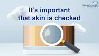 How to Avoid Getting a Pressure Ulcer