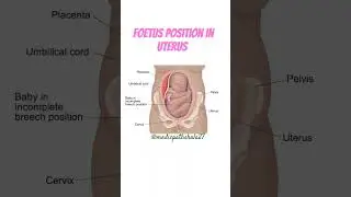 How Baby lies in uterus | Foetal Position #viral #shorts