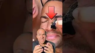 😱 PICKEL & MITESSER ENTFERNEN⁉️ anzeige #biore #influeltern #hautpflege #pickel #pimplefree #nase