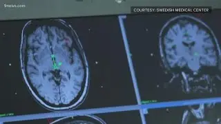 Neurologist discusses breakthroughs in diagnosis and treatment of Parkinson's disease